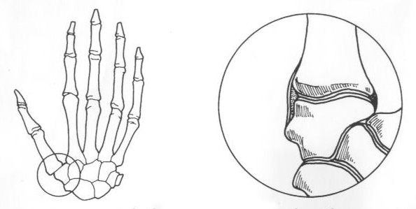 Image result for diagram of basilar thumb arthritis