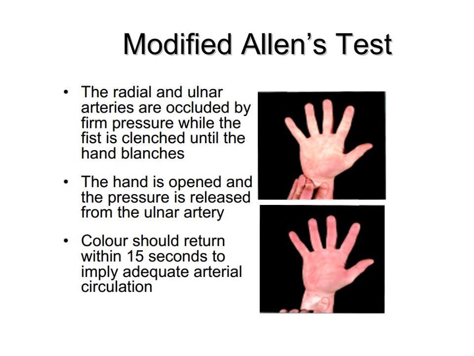 Allentest - Allen Test Programed Training Course 16-000 Series Engine ... : Go.amboss.com/allentest the modified allen test is used to.