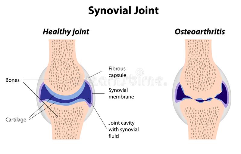 Image result for image of normal synovial joint