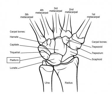 Image result for image of wrist bones