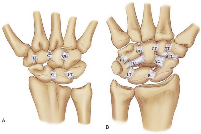 Image result for picture of intrinsic ligaments of wrist