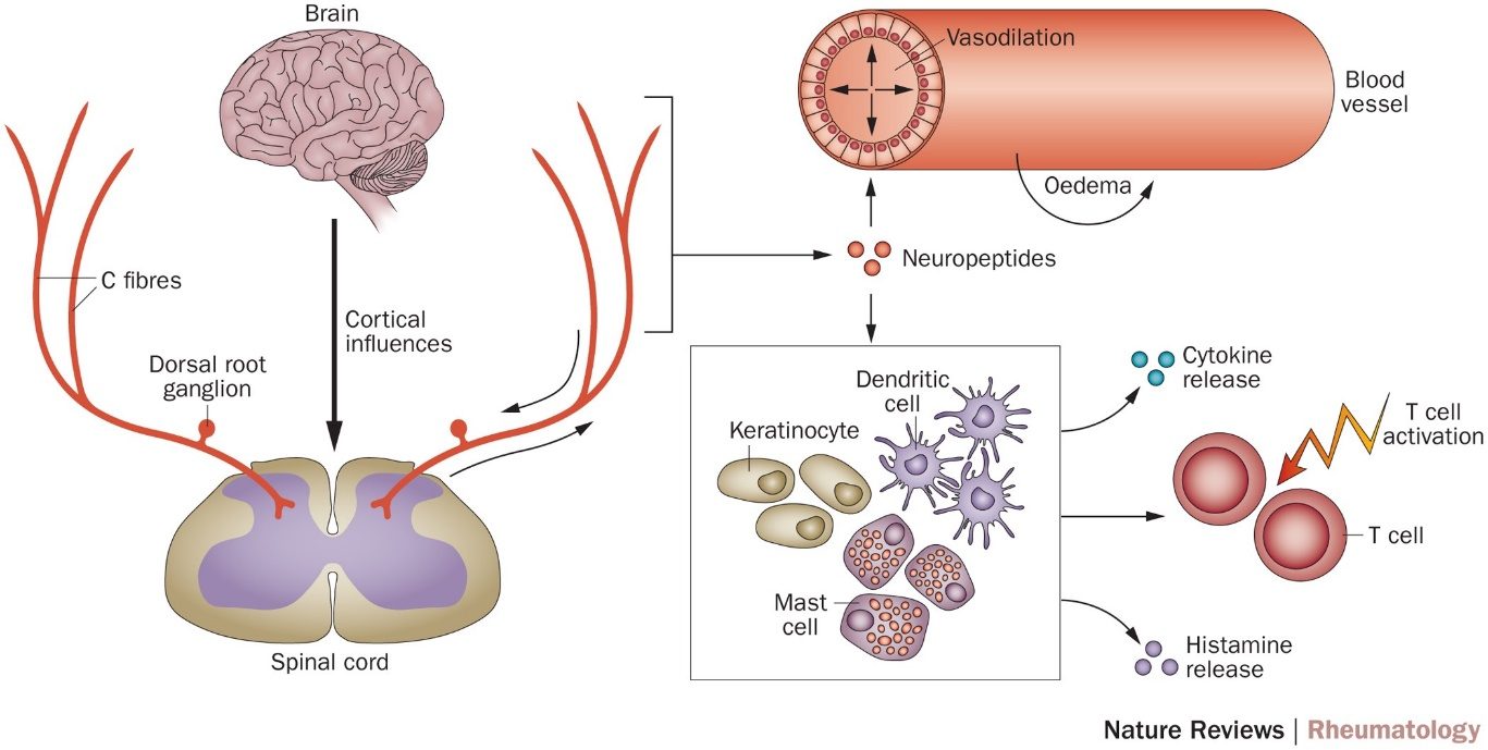 CRPS Overview